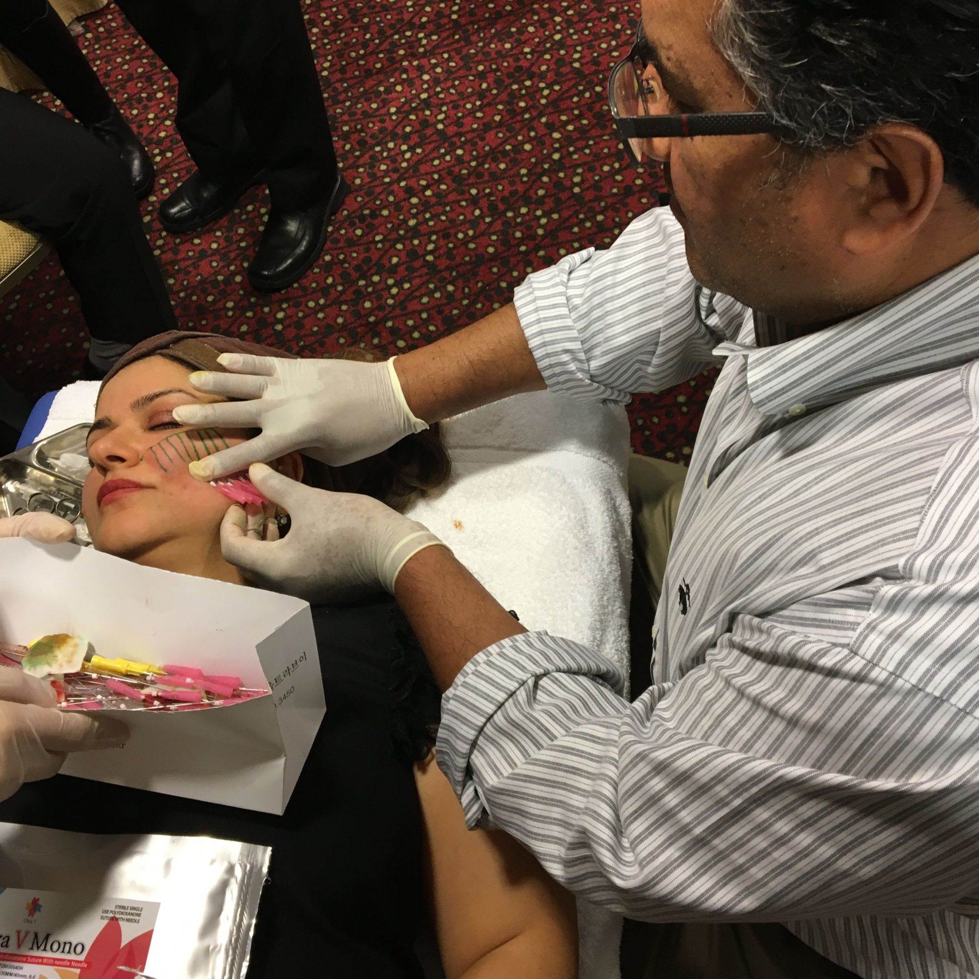 dr atul kesarwani performing thread lift