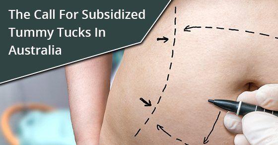 subsidized tummy tucks