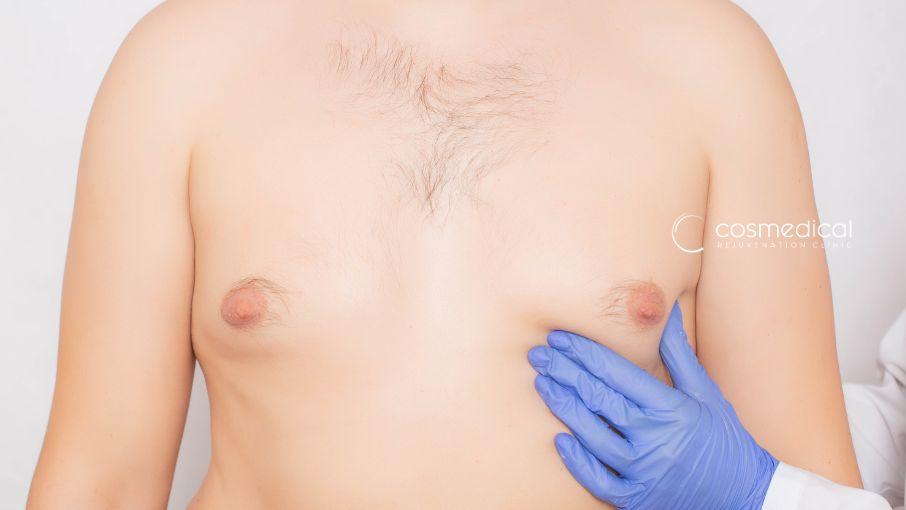 breast augmentation for men