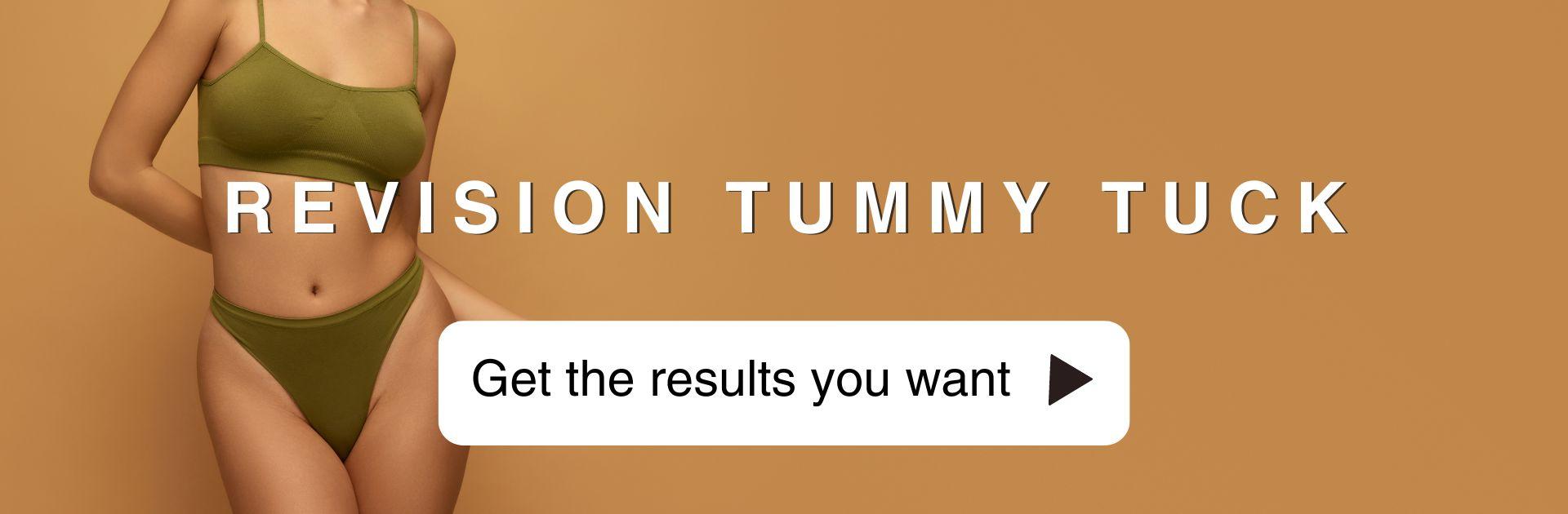 Tummy Tuck Revision - Hourglass Tummy Tuck