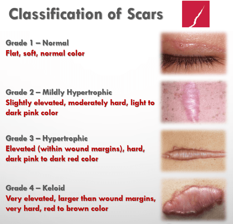  scar types